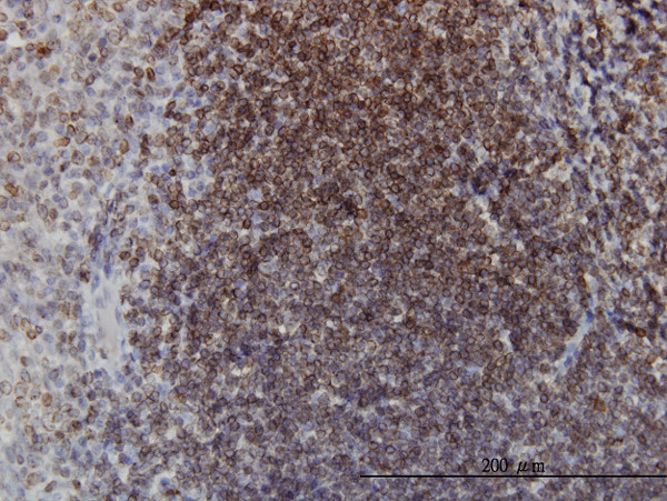 EPHB3 Antibody in Immunohistochemistry (Paraffin) (IHC (P))