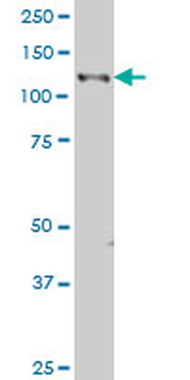 EPHB3 Antibody in Western Blot (WB)