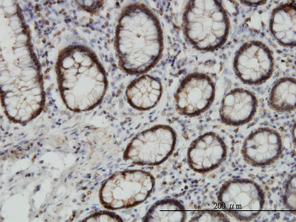 EPHB3 Antibody in Immunohistochemistry (Paraffin) (IHC (P))