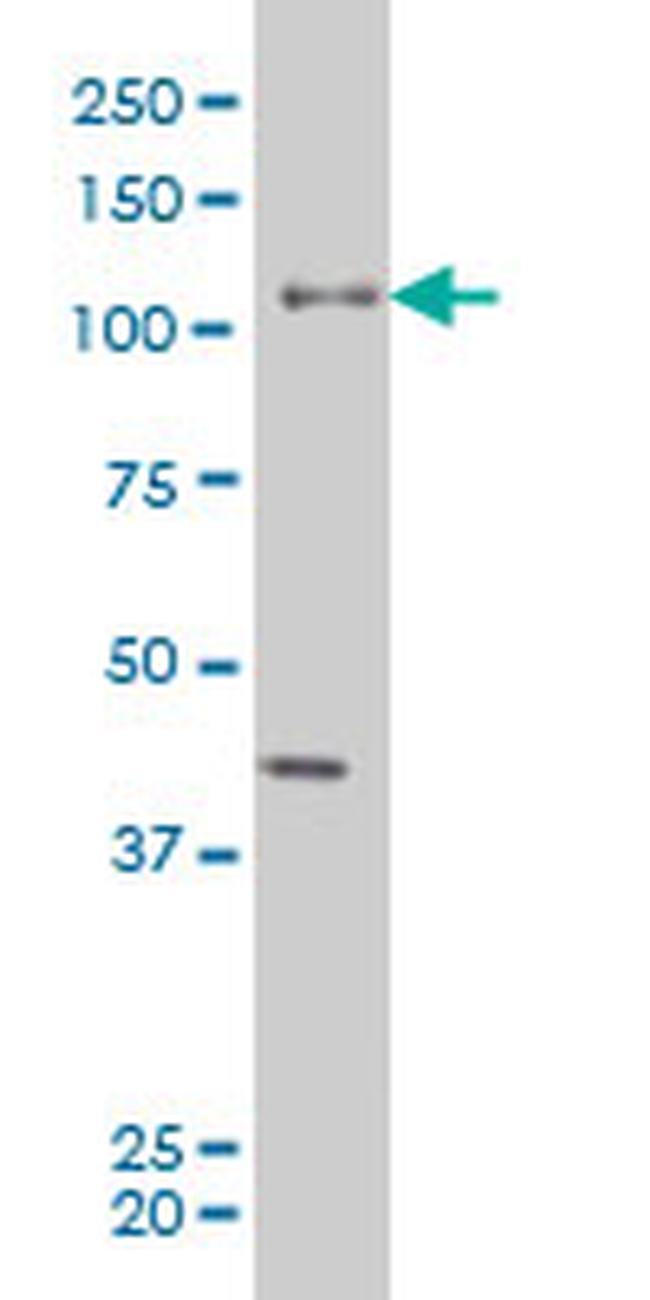 EPHB3 Antibody in Western Blot (WB)