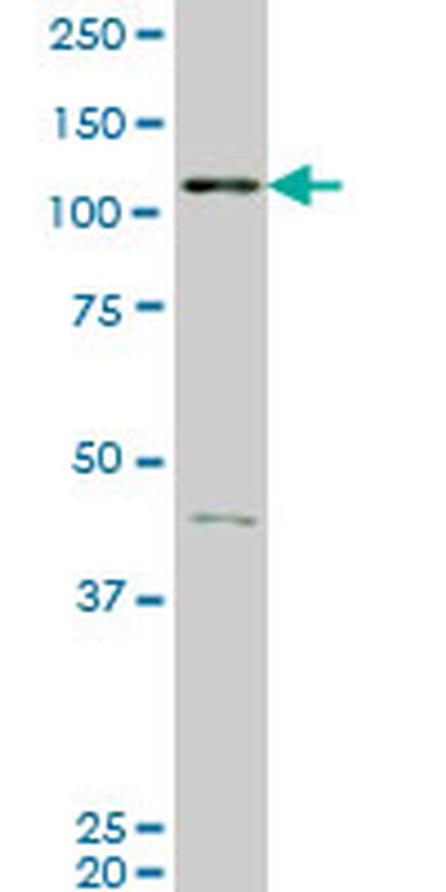 EPHB3 Antibody in Western Blot (WB)