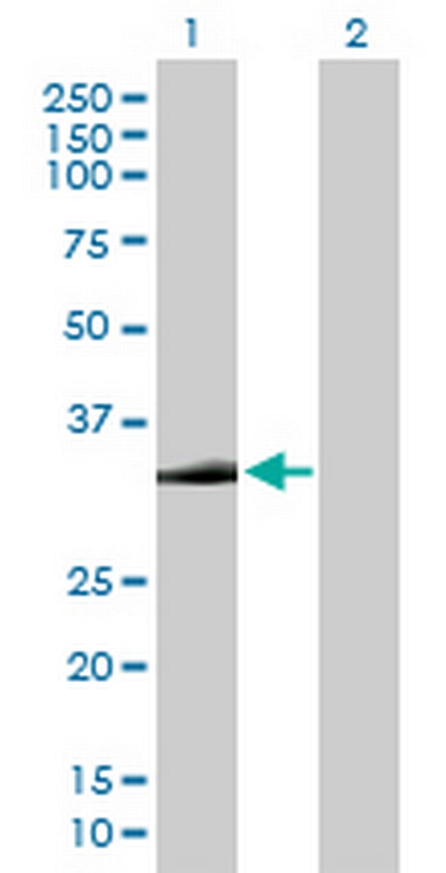 STX2 Antibody in Western Blot (WB)