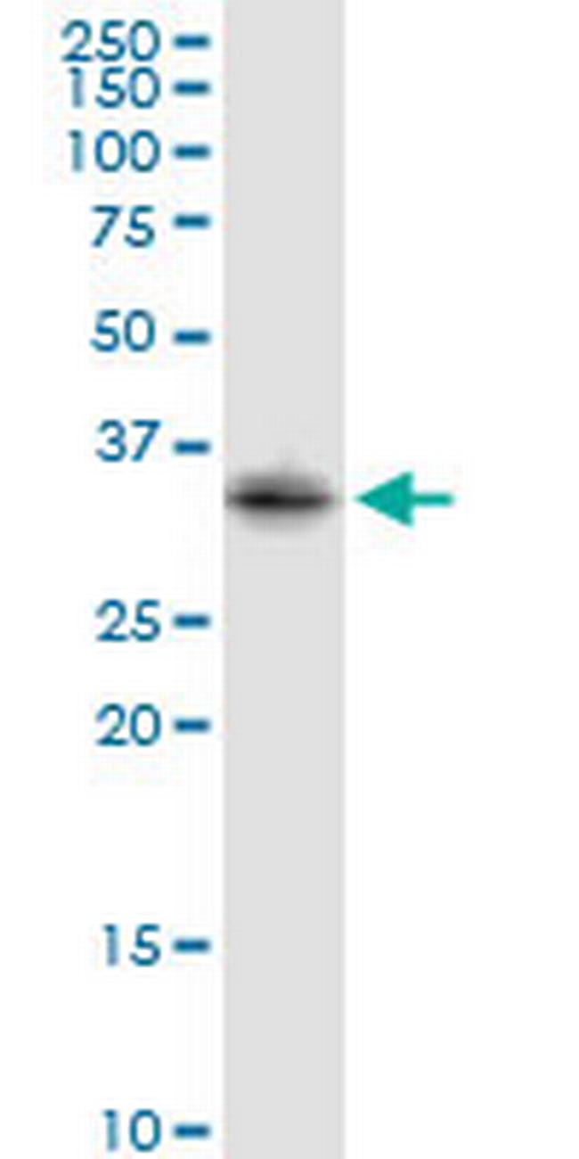 STX2 Antibody in Western Blot (WB)