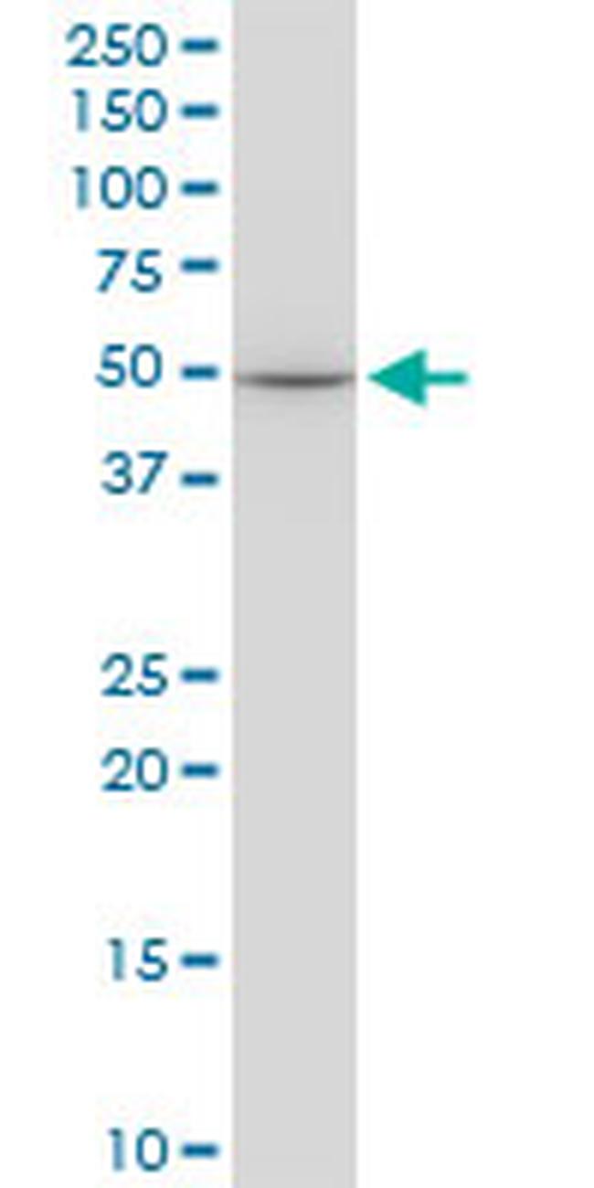 EPOR Antibody in Western Blot (WB)