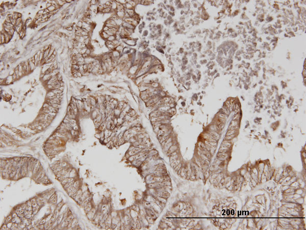 ERBB3 Antibody in Immunohistochemistry (Paraffin) (IHC (P))