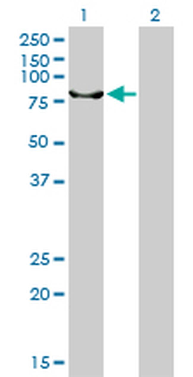 ERCC2 Antibody in Western Blot (WB)