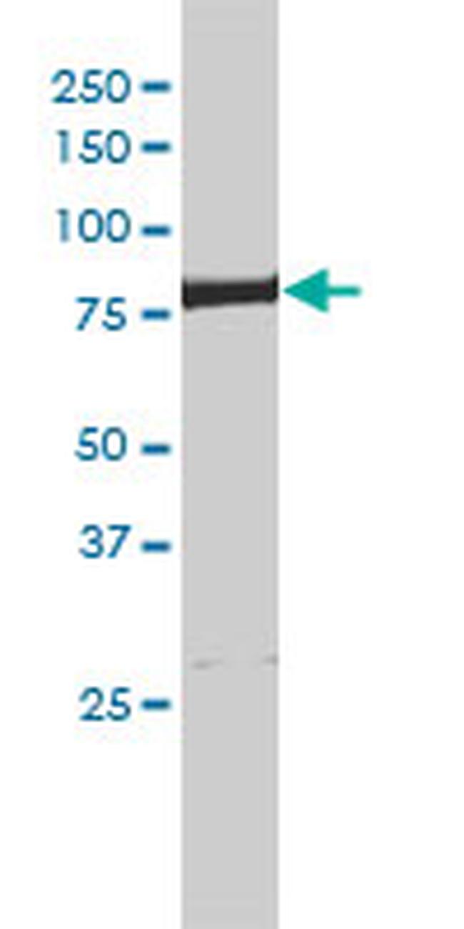 ERCC2 Antibody in Western Blot (WB)