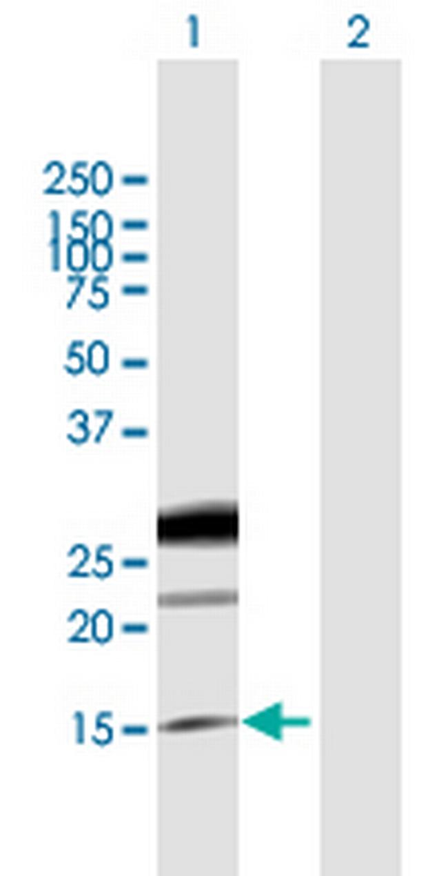 EREG Antibody in Western Blot (WB)