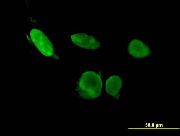 ERF Antibody in Immunocytochemistry (ICC/IF)