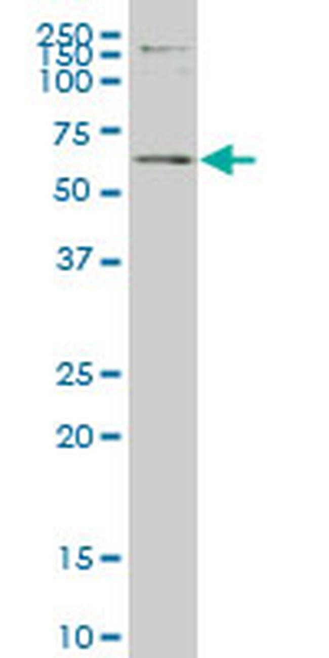 ERF Antibody in Western Blot (WB)