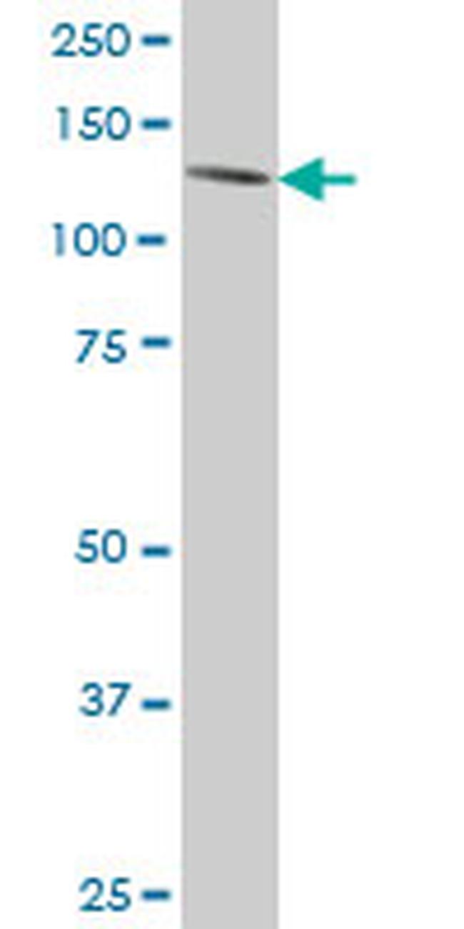 ERN1 Antibody in Western Blot (WB)