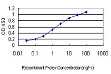 ERN1 Antibody in ELISA (ELISA)