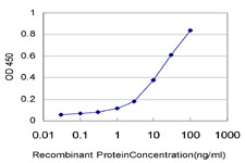 ERN1 Antibody in ELISA (ELISA)