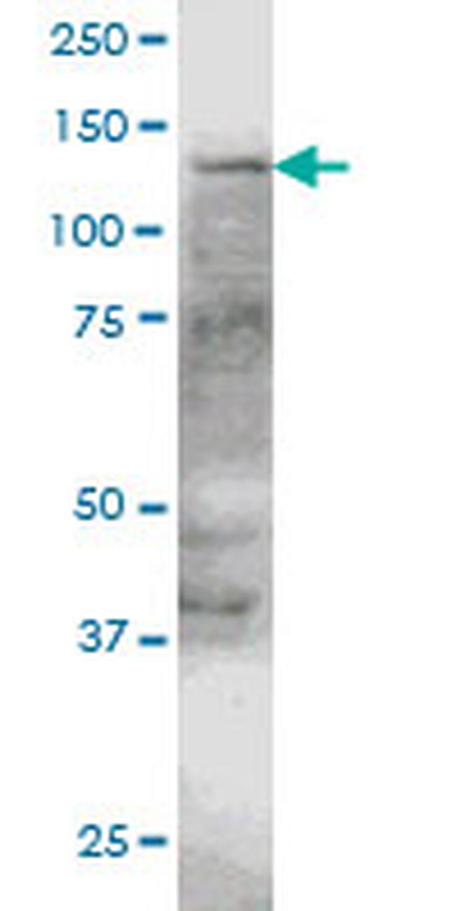 ERN1 Antibody in Western Blot (WB)