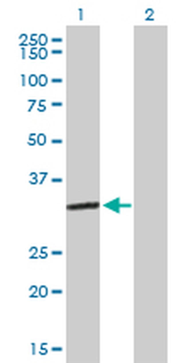 ESD Antibody in Western Blot (WB)