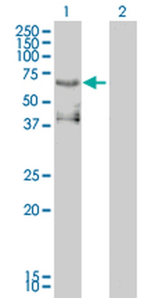 ETV4 Antibody in Western Blot (WB)