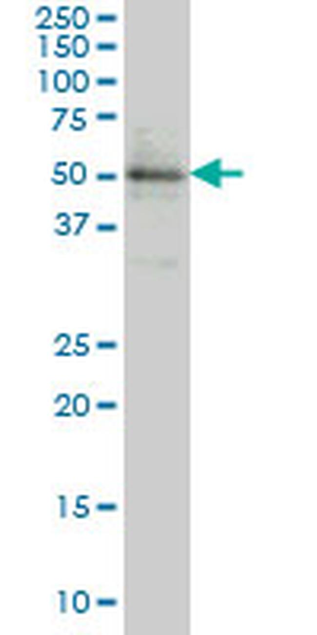 ETV5 Antibody in Western Blot (WB)