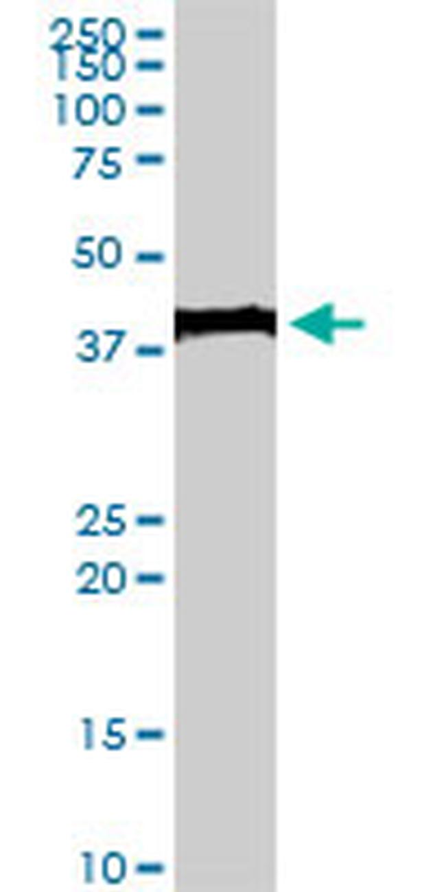 EVX1 Antibody in Western Blot (WB)