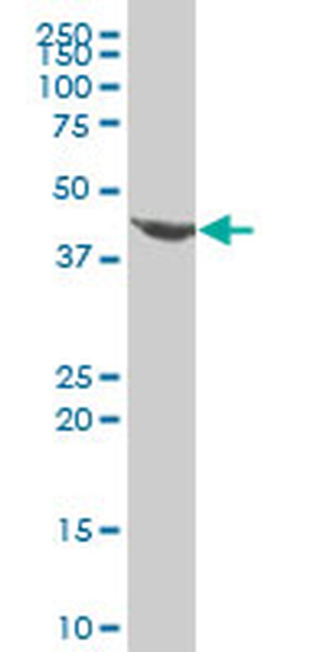 EVX1 Antibody in Western Blot (WB)