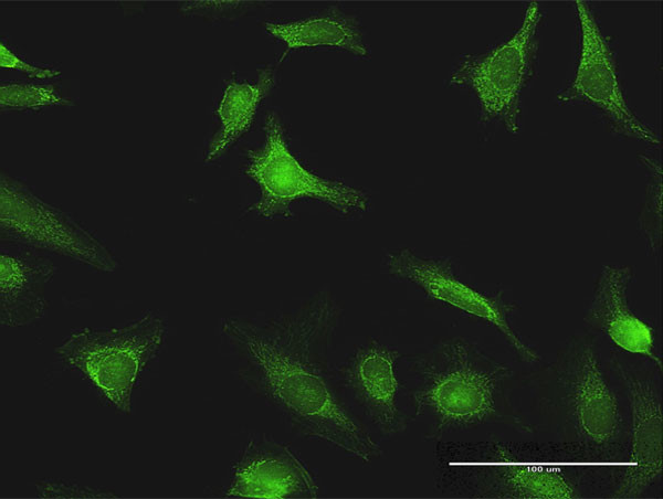 EXT1 Antibody in Immunocytochemistry (ICC/IF)