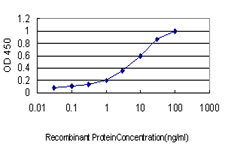 EXT2 Antibody in ELISA (ELISA)