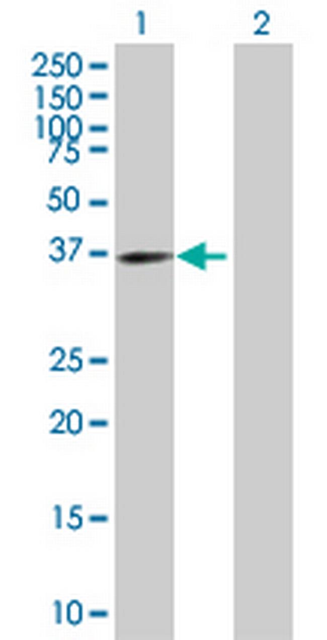 EXTL2 Antibody in Western Blot (WB)