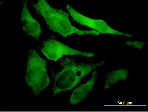 EYA2 Antibody in Immunocytochemistry (ICC/IF)