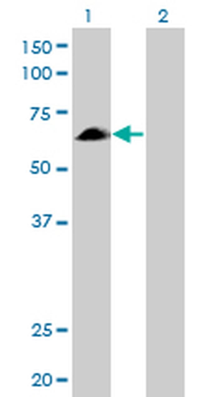 EYA2 Antibody in Western Blot (WB)