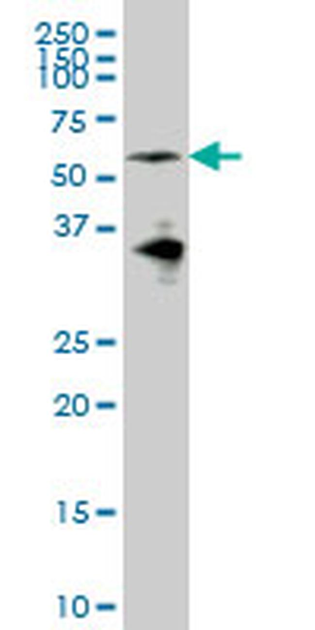 EYA2 Antibody in Western Blot (WB)