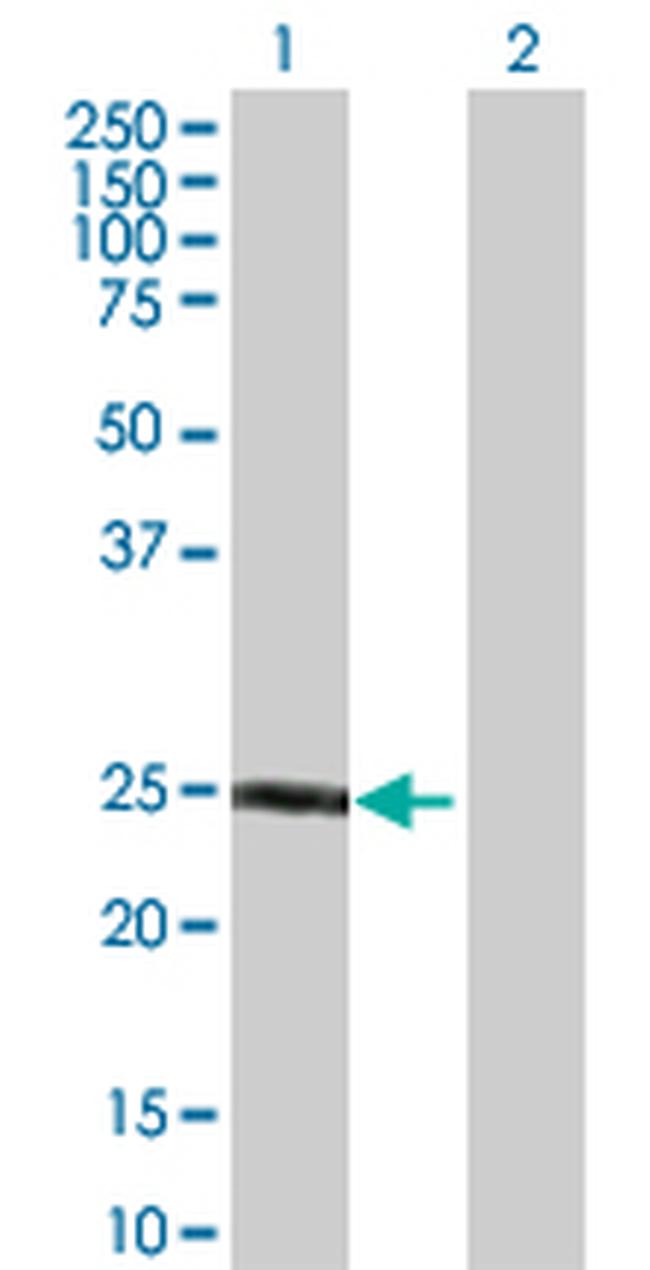 F8 Antibody in Western Blot (WB)