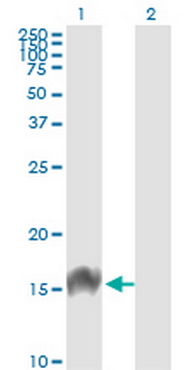 FABP4 Antibody in Western Blot (WB)