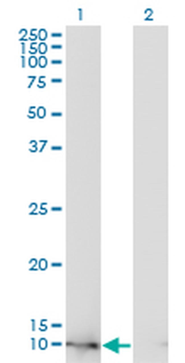 FABP4 Antibody in Western Blot (WB)