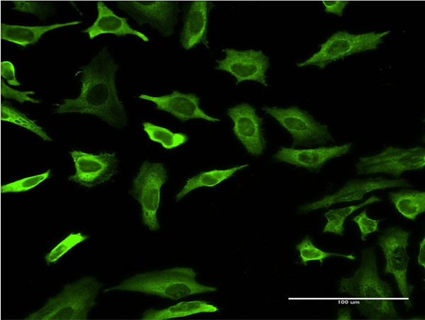 FABP4 Antibody in Immunocytochemistry (ICC/IF)