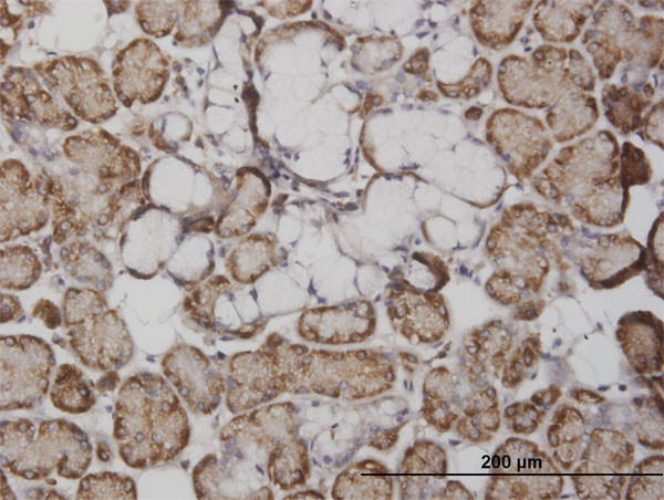 FABP4 Antibody in Immunohistochemistry (Paraffin) (IHC (P))