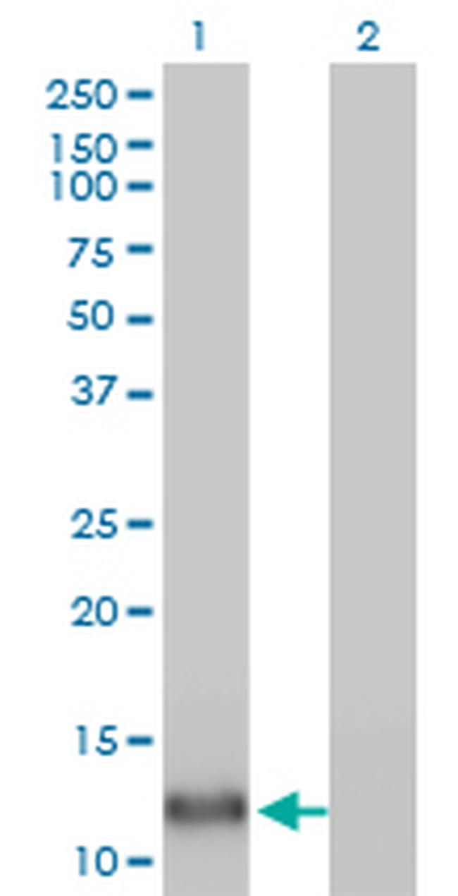 FABP4 Antibody in Western Blot (WB)