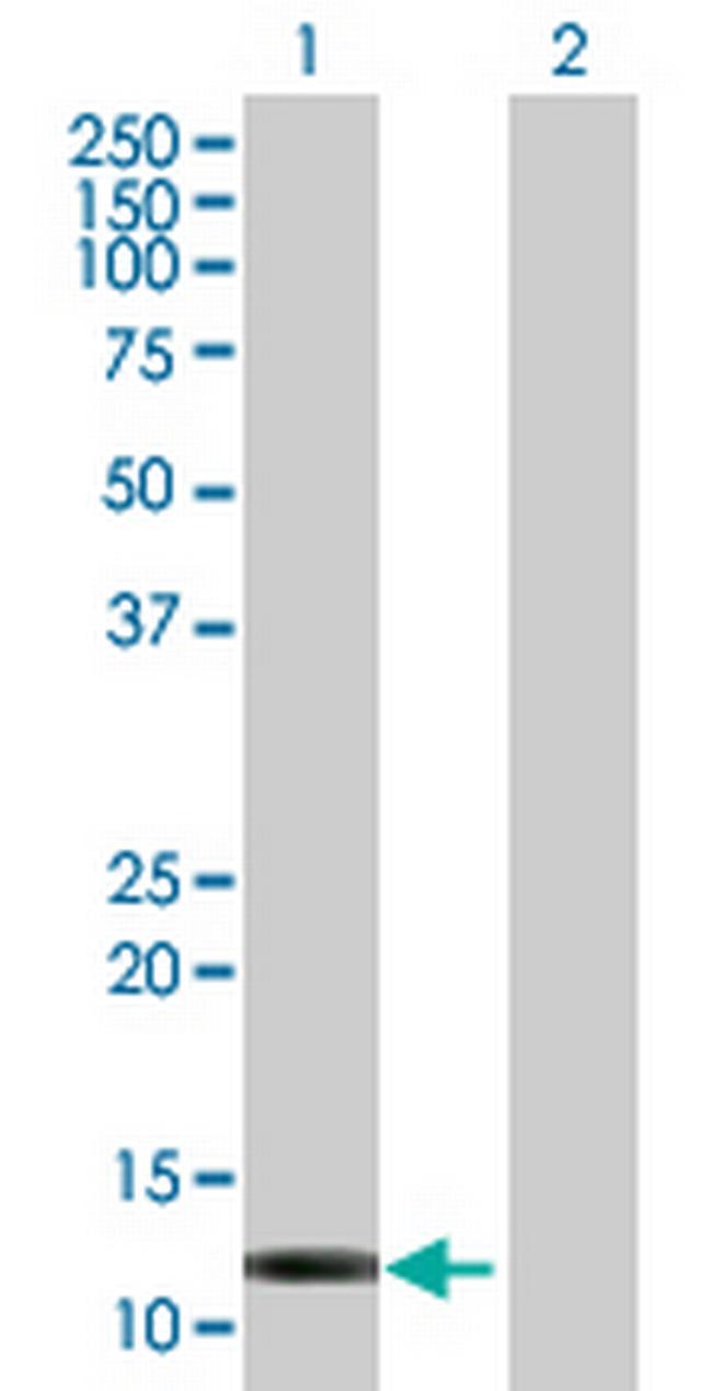 FABP6 Antibody in Western Blot (WB)