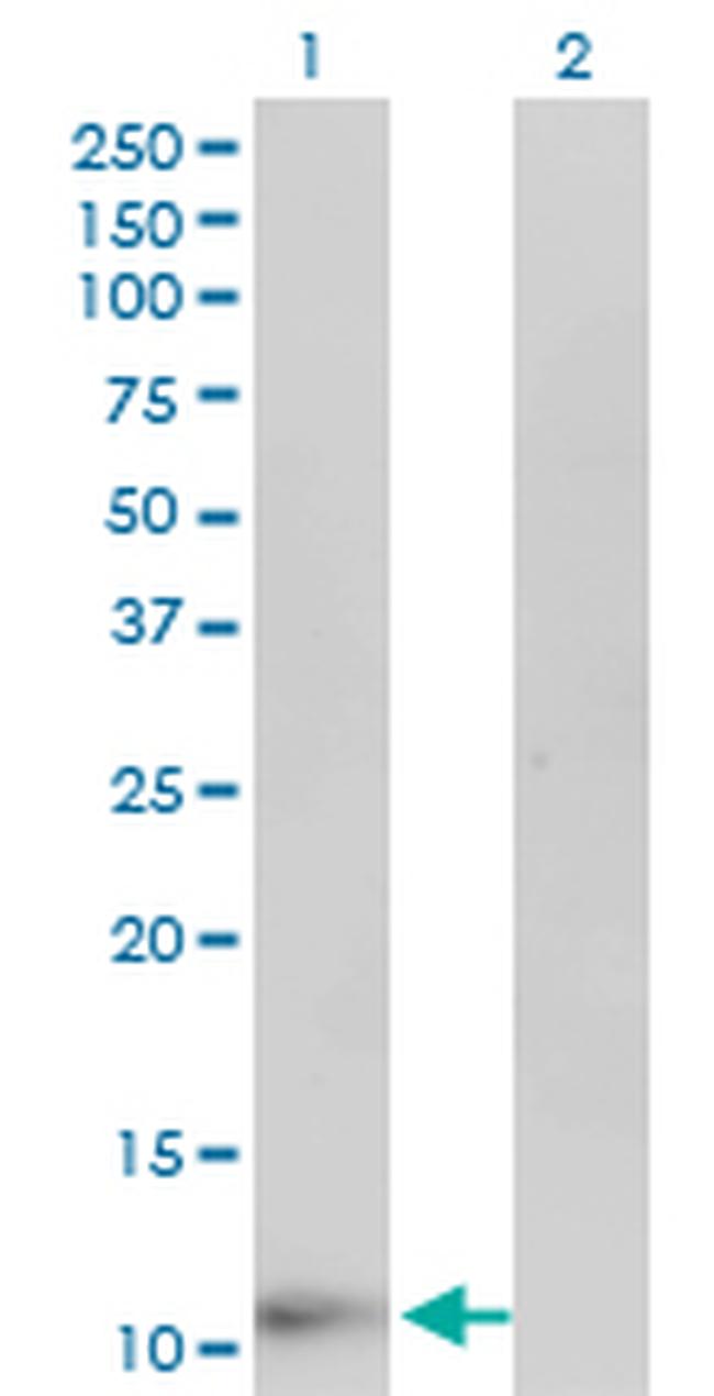 FABP6 Antibody in Western Blot (WB)