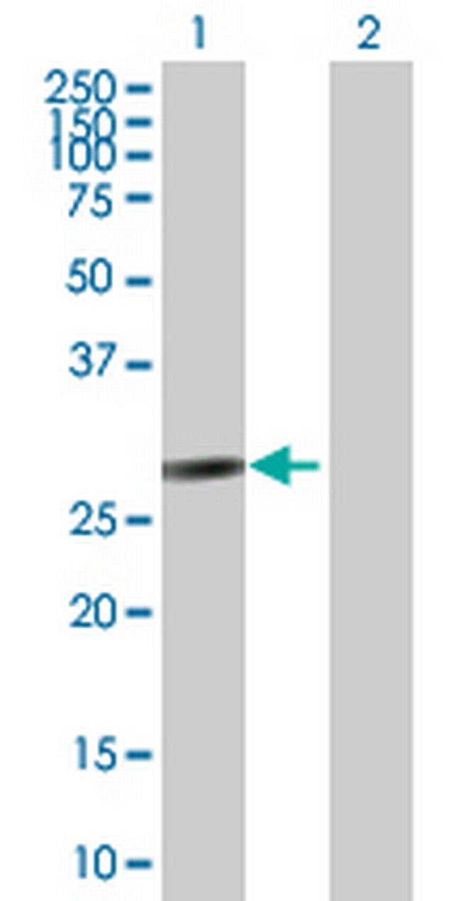 FANCA Antibody in Western Blot (WB)