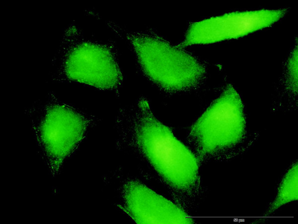 PTK2B Antibody in Immunocytochemistry (ICC/IF)