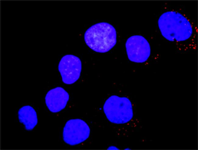 PTK2B Antibody in Proximity Ligation Assay (PLA) (PLA)