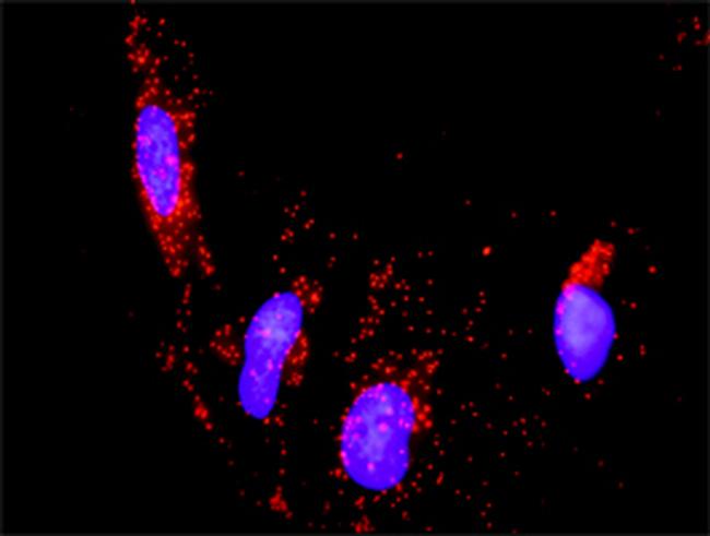 PTK2B Antibody in Proximity Ligation Assay (PLA) (PLA)