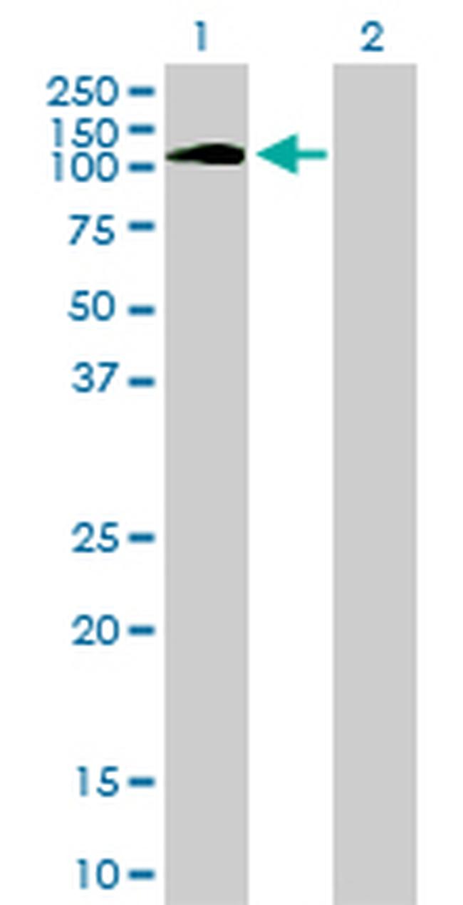 PTK2B Antibody in Western Blot (WB)