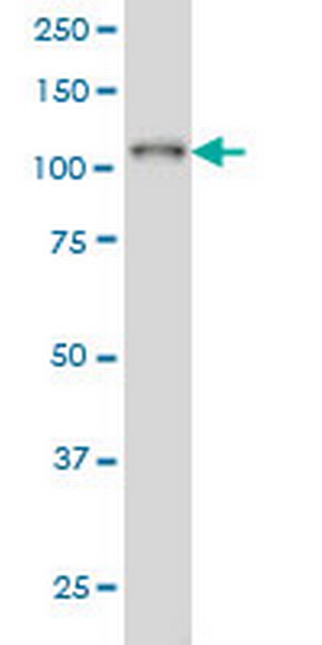 PTK2B Antibody in Western Blot (WB)