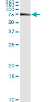 FANCG Antibody in Immunoprecipitation (IP)