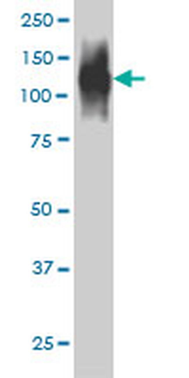 FAP Antibody in Western Blot (WB)