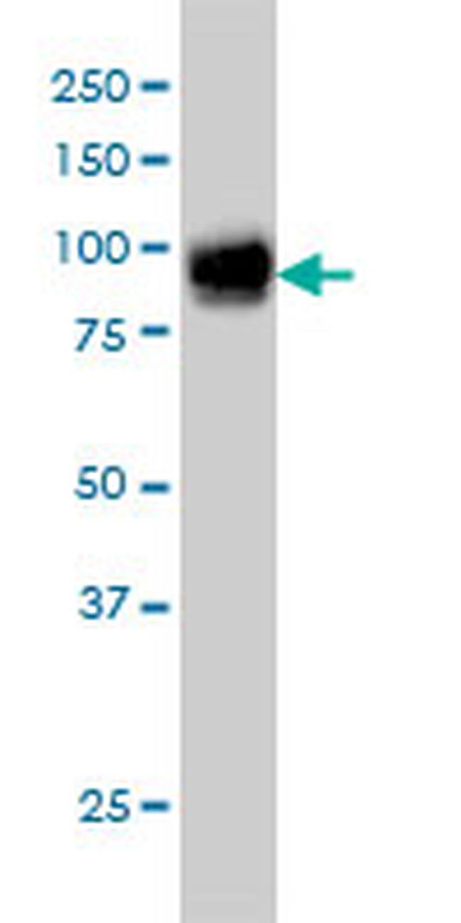 FBLN1 Antibody in Western Blot (WB)