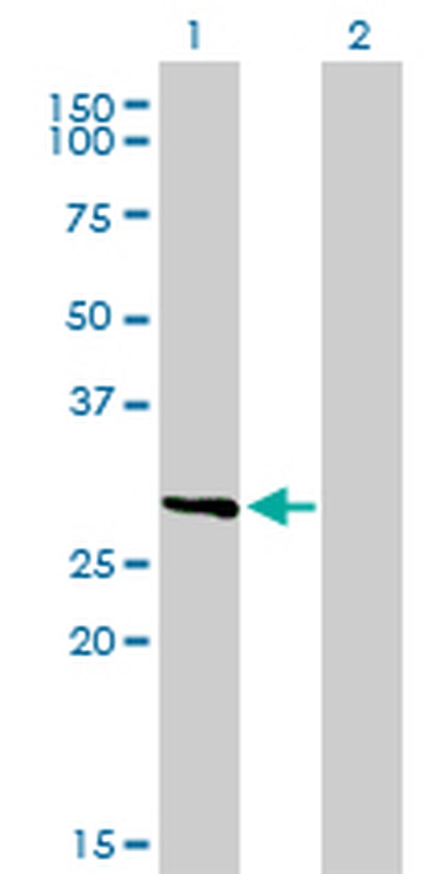 FCER1A Antibody in Western Blot (WB)