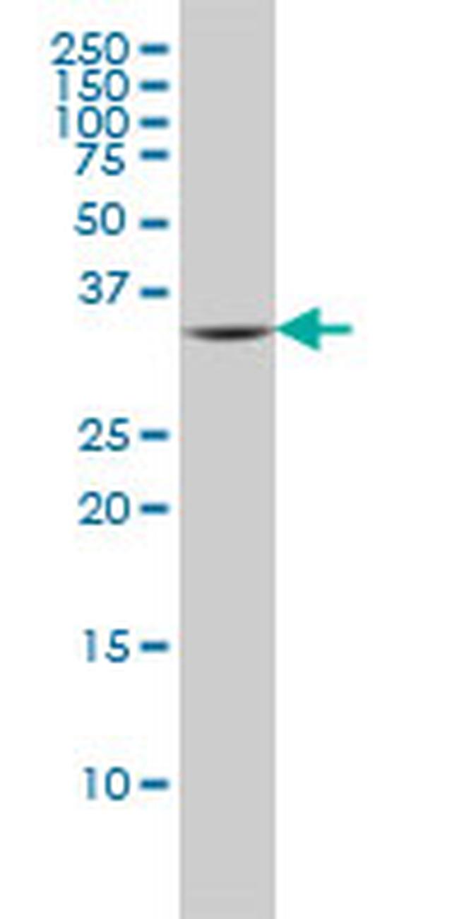 FCER1A Antibody in Western Blot (WB)