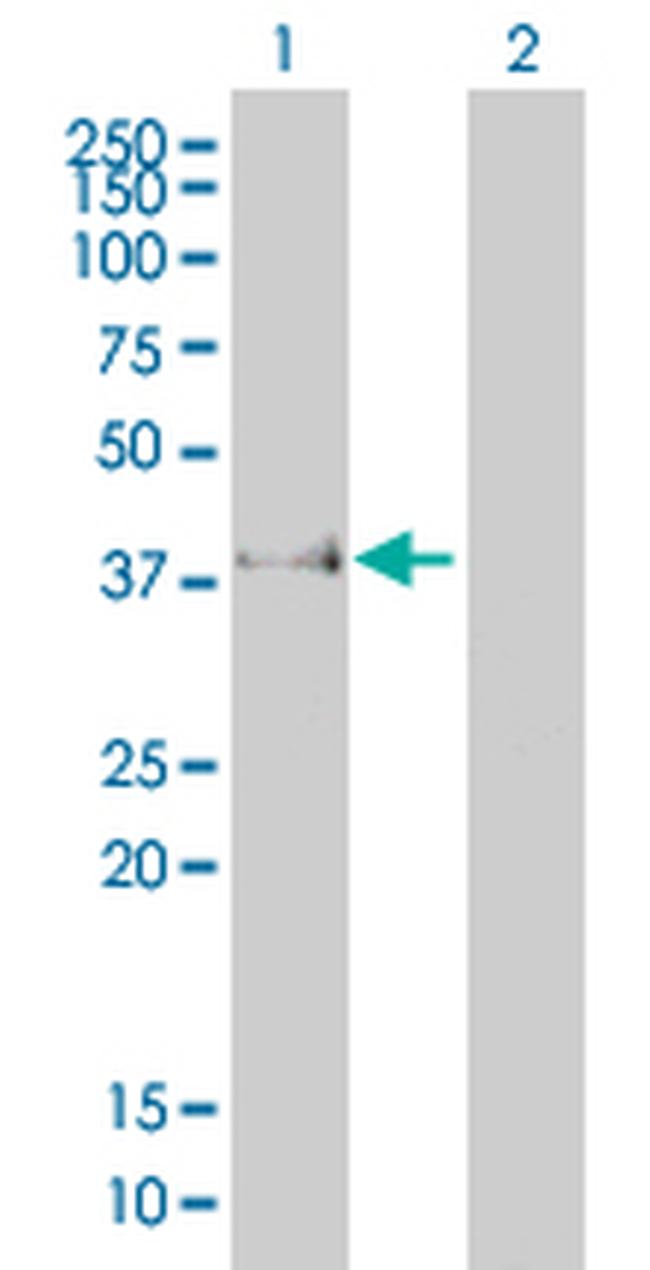 FCGR2B Antibody in Western Blot (WB)