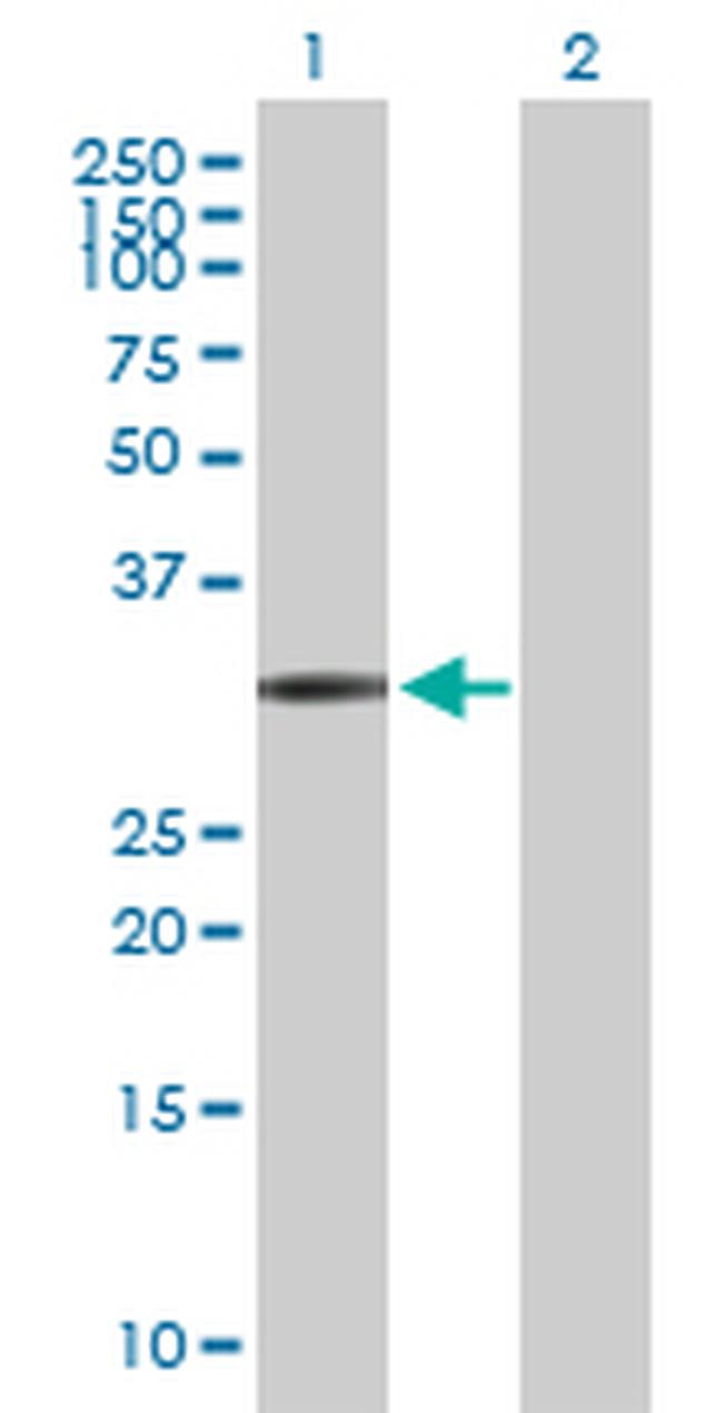 FCN1 Antibody in Western Blot (WB)